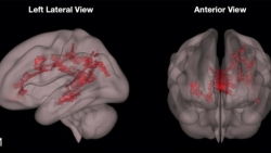 hinh anh khac biet giua nao bo cua tre doc sach va tre xem dien thoai