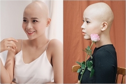 nu sinh mac ung thu khi 20 tuoi dau don cung la mot dang trai nghiem