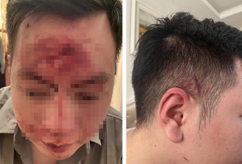 nhan vien quan bar hanh hung khach vi moi ruou khong uong