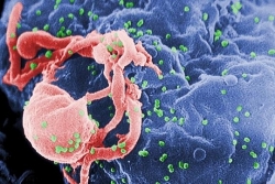 Đằng sau ba trường hợp bệnh nhân được chữa khỏi HIV
